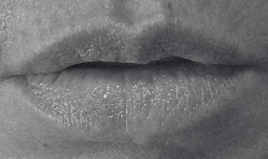 Labios antes del relleno