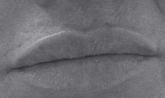 Labios después del relleno